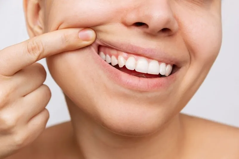 Periodontal Care