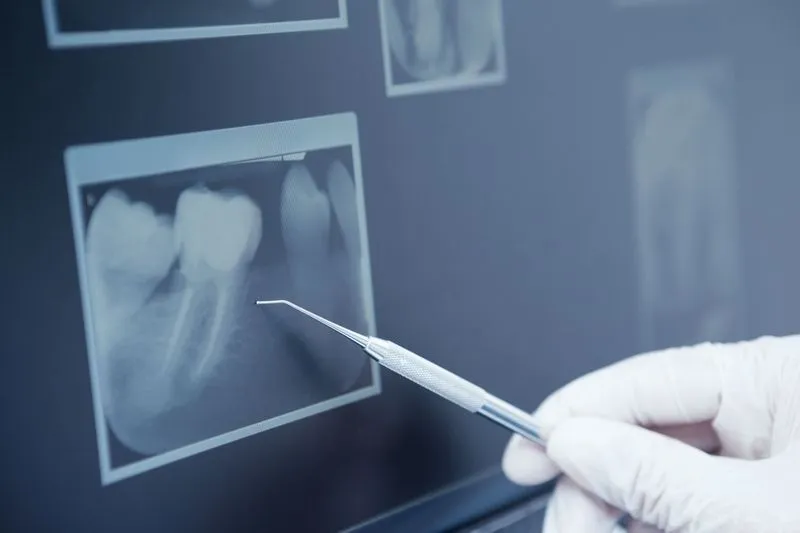 dental xrays
