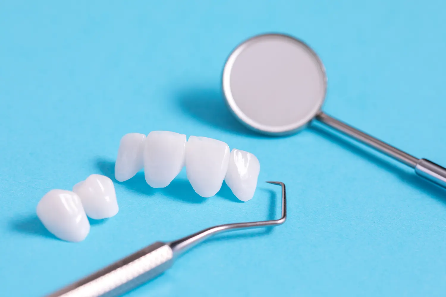 Veneers