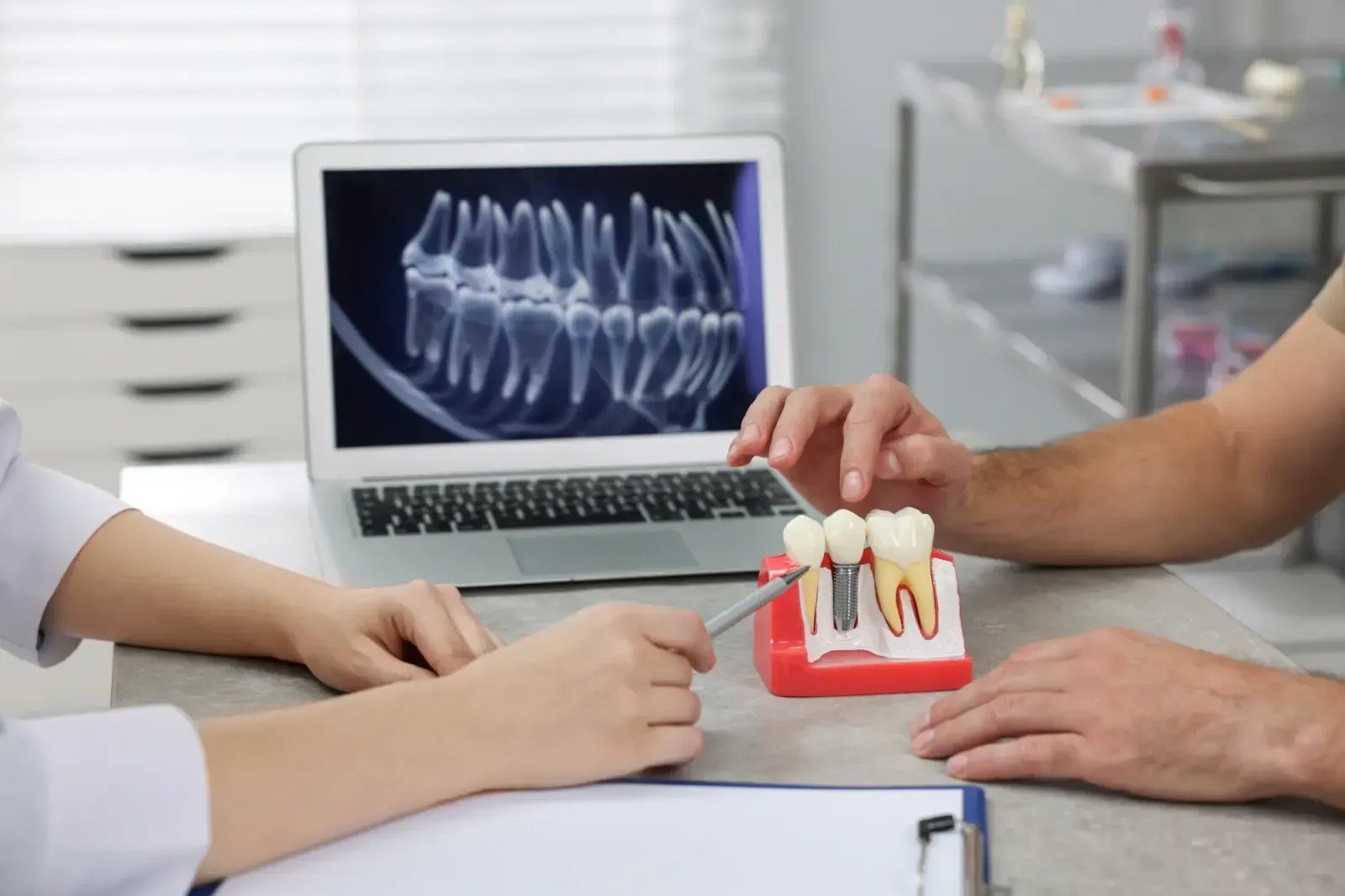 Dental Implants