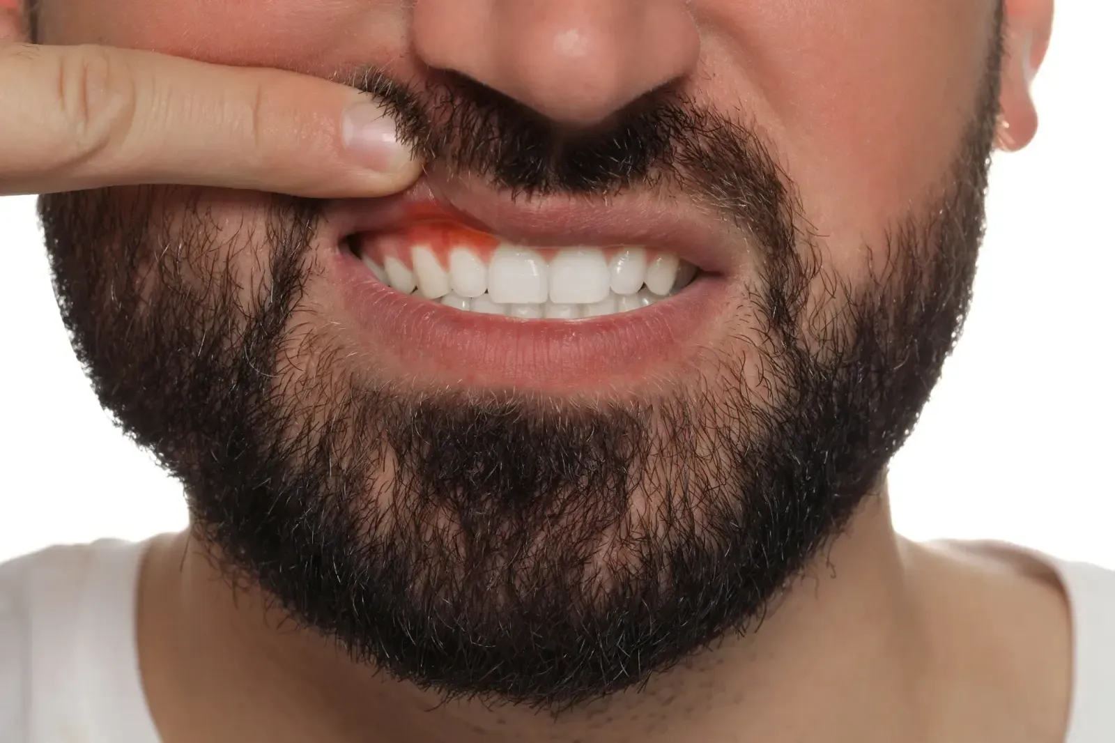 Gum Health