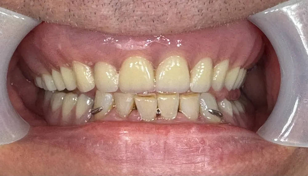 teeth