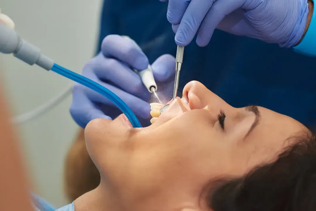 teeth cleaning