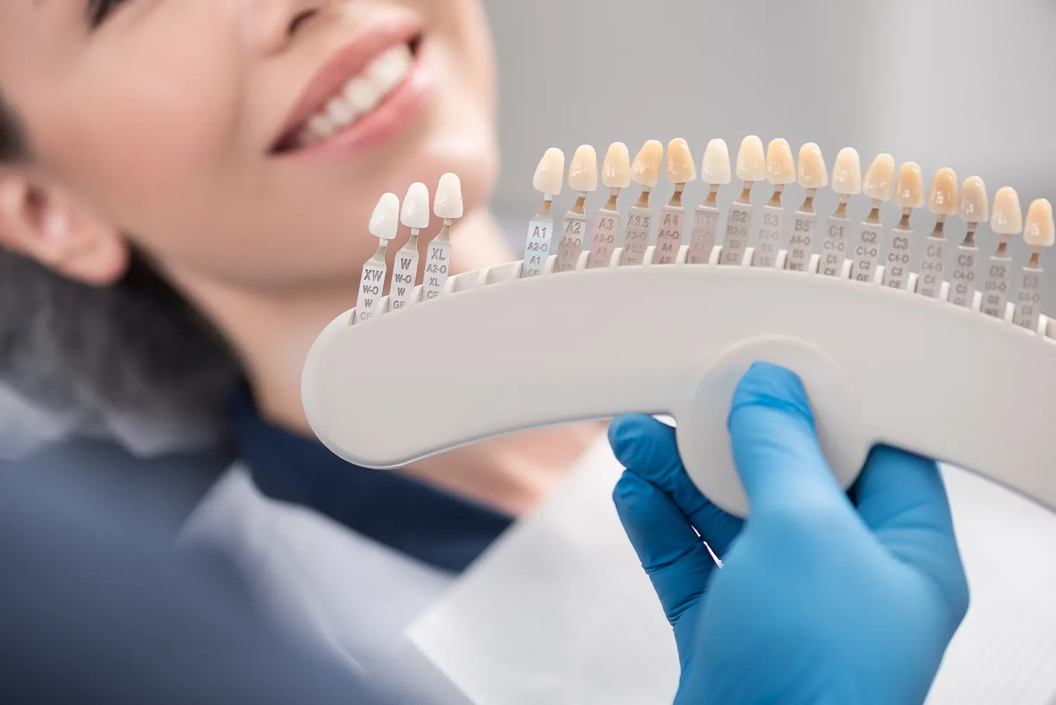 veneers