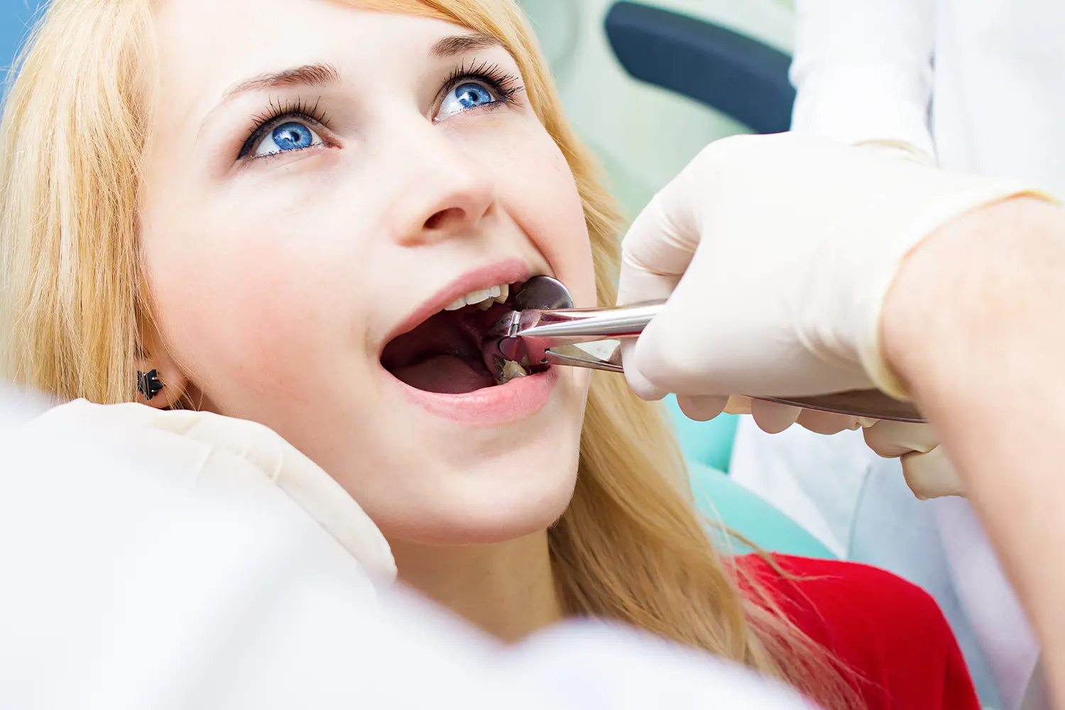 wisdom tooth